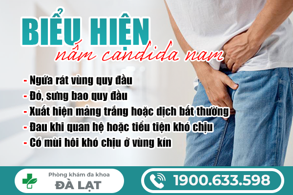 Hình ảnh minh họa